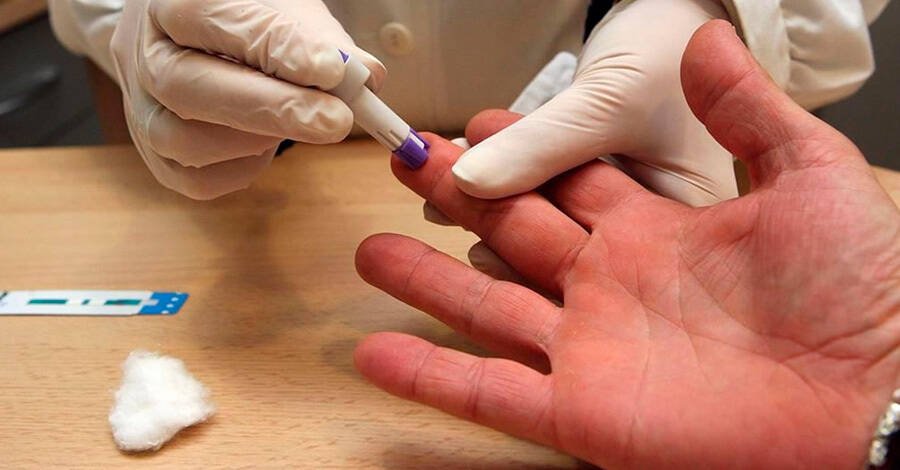 test de VIH en la intendencia