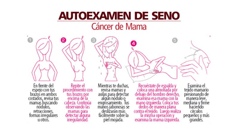 autoexamen de mamas